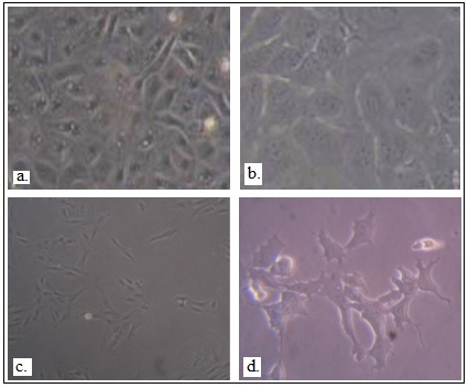 Figure 2
Differentiation of hESCs into lung- lineage specific cells