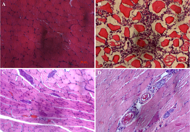 Figure 5
The changes in histology of hindlimb muscles after treatment